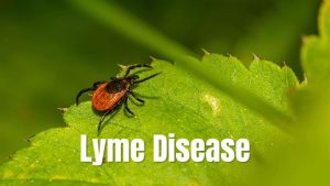 What is Lyme Disease ? This Tiny Bug Can Ruin Your Life!